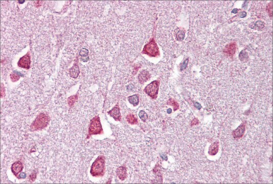 抗CACNA1G ウサギ宿主抗体 affinity isolated antibody