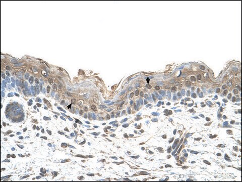 Anti-RPN2 antibody produced in rabbit affinity isolated antibody