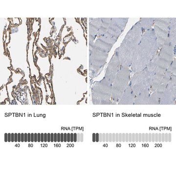 Anti-SPTBN1 antibody produced in rabbit Prestige Antibodies&#174; Powered by Atlas Antibodies, affinity isolated antibody, buffered aqueous glycerol solution