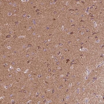 Anti-MAPK11 antibody produced in rabbit Prestige Antibodies&#174; Powered by Atlas Antibodies, affinity isolated antibody, buffered aqueous glycerol solution