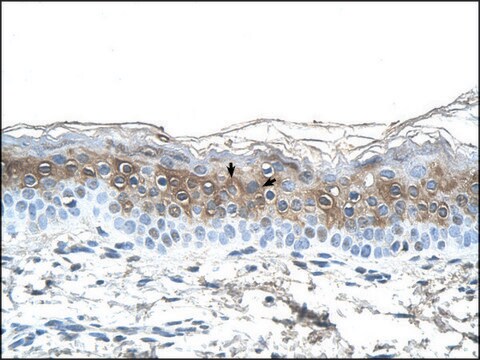 Anti-FGA IgG fraction of antiserum