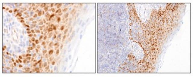 Anti-FoxP2 Antibody, clone FOXP2-73A/8 clone FOXP2-73A/8, from mouse