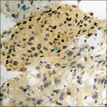 Anti-phospho-Retinoblastoma (pSer608) antibody produced in rabbit affinity isolated antibody