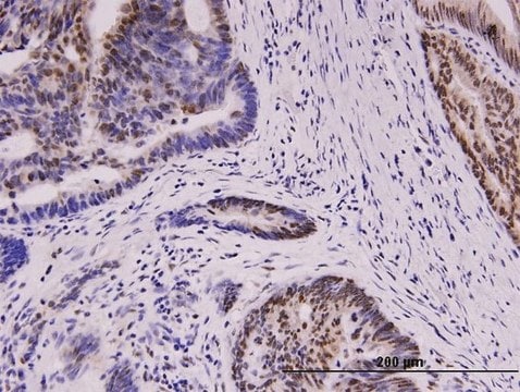 Monoclonal Anti-WT1 antibody produced in mouse clone 1E9, purified immunoglobulin, buffered aqueous solution