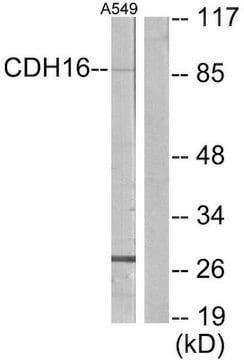 Anti-CDH16 antibody produced in rabbit affinity isolated antibody