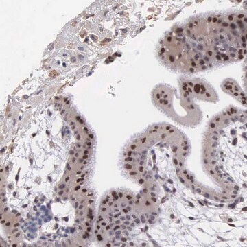 Anti-SLC25A21 antibody produced in rabbit Prestige Antibodies&#174; Powered by Atlas Antibodies, affinity isolated antibody, buffered aqueous glycerol solution