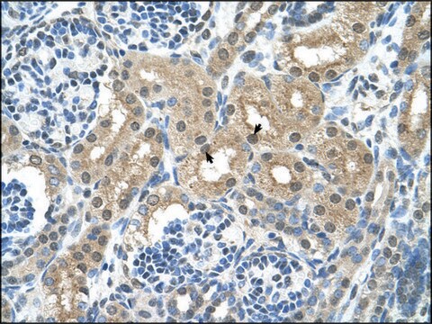 Anti-GPT (AB2) antibody produced in rabbit IgG fraction of antiserum