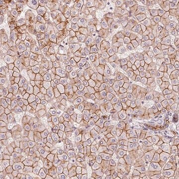 Anti-SLC17A4 antibody produced in rabbit Prestige Antibodies&#174; Powered by Atlas Antibodies, affinity isolated antibody