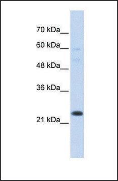 Anti-TAF12, (N-terminal) antibody produced in rabbit affinity isolated antibody