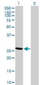 Anti-RCAN2 antibody produced in mouse purified immunoglobulin, buffered aqueous solution