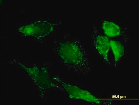 Anti-PDHX antibody produced in mouse IgG fraction of antiserum, buffered aqueous solution