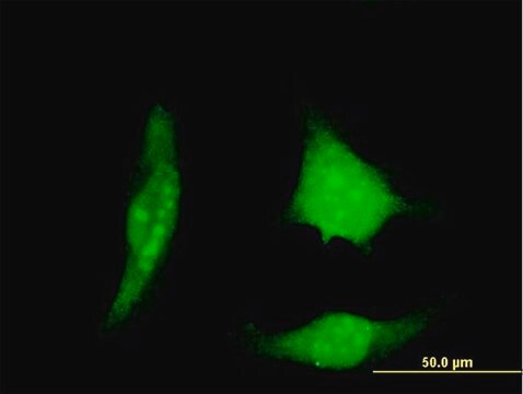 Monoclonal Anti-DSCR1 antibody produced in mouse clone 1B1, purified immunoglobulin, buffered aqueous solution