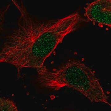 Anti-Nme7 Antibody Produced In Rabbit Prestige Antibodies&#174; Powered by Atlas Antibodies, affinity isolated antibody, buffered aqueous glycerol solution