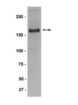 Anticuerpo anti-MLL/HRX, CT., clon 9-12 clone 9-12, Upstate&#174;, from mouse