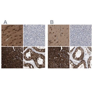 Anti-GARS antibody produced in rabbit Prestige Antibodies&#174; Powered by Atlas Antibodies, affinity isolated antibody, buffered aqueous glycerol solution