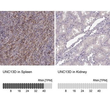 Anti-UNC13D antibody produced in rabbit affinity isolated antibody