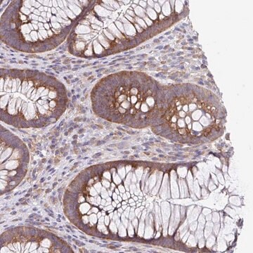 Anti-EIF4B antibody produced in rabbit Prestige Antibodies&#174; Powered by Atlas Antibodies, affinity isolated antibody, buffered aqueous glycerol solution