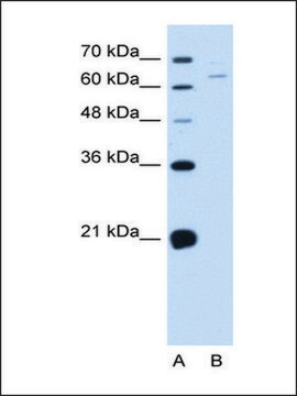 Anti-NOX1 affinity isolated antibody