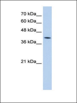 Anti-M6PR antibody produced in rabbit IgG fraction of antiserum