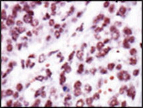 Anti-PKC&#949; (N-term) antibody produced in rabbit IgG fraction of antiserum, buffered aqueous solution