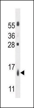 ANTI-TMEM218 (CENTER) antibody produced in rabbit IgG fraction of antiserum, buffered aqueous solution