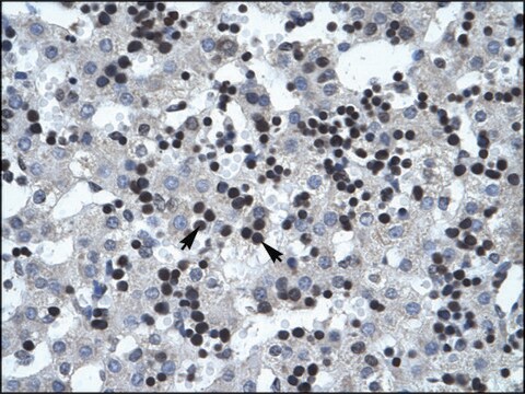 Anti-SMARCB1 antibody produced in rabbit affinity isolated antibody