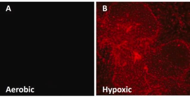 Anti-EF5 Antibody, clone ELK3-51 Antibody, Cyanine 5 conjugate clone ELK3-51, from mouse, CY5 conjugate