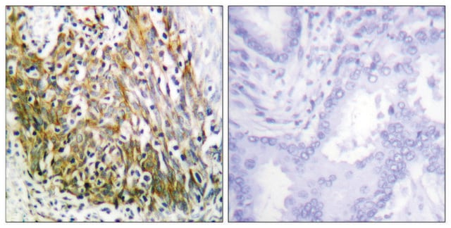 Anti-MMP-10 antibody produced in rabbit affinity isolated antibody