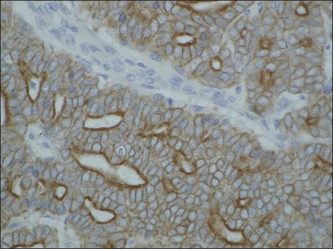 Monoclonal Anti-Cytokeratin (Pan-reactive) antibody produced in mouse clone C-11, purified immunoglobulin, buffered aqueous solution