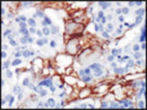 Anti-PIP5K2B (C-term) antibody produced in rabbit IgG fraction of antiserum, buffered aqueous solution