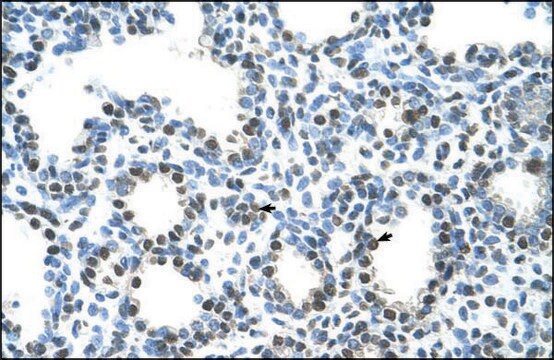 Semg1 Ab1 Antibody Immunohistochemistry Western Av42088 Anti Sgi