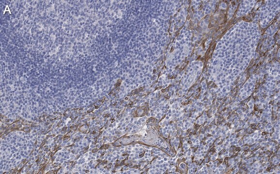 Anti-Cytokeratin 5/6 Antibody, clone D5/16 B4 ZooMAb&#174; Mouse Monoclonal recombinant, expressed in HEK 293 cells