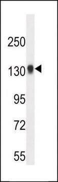 ANTI-TDRD7 (C-TERM) antibody produced in rabbit IgG fraction of antiserum, buffered aqueous solution