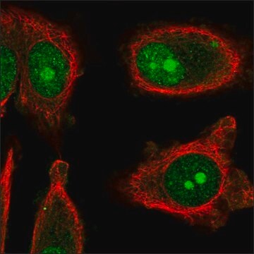 Anti-IL13RA2 antibody produced in rabbit Prestige Antibodies&#174; Powered by Atlas Antibodies, affinity isolated antibody