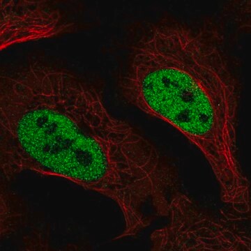 Anti-SLC4A3 antibody produced in rabbit Prestige Antibodies&#174; Powered by Atlas Antibodies, affinity isolated antibody