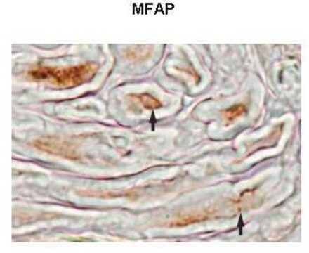 Anti-MFAP4 antibody produced in rabbit affinity isolated antibody