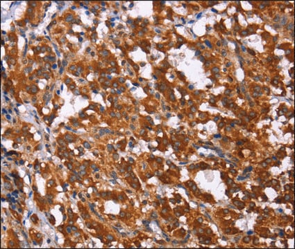 Anti-GPR65 antibody produced in rabbit affinity isolated antibody