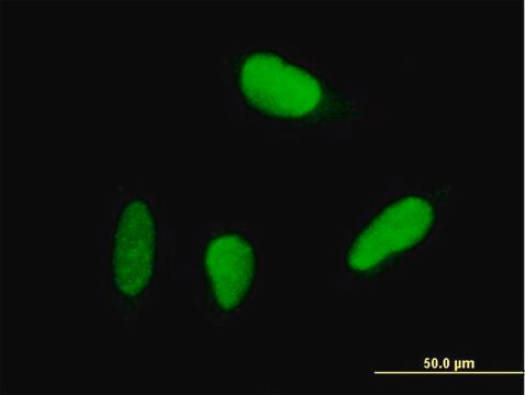 Anti-USP18 antibody produced in mouse purified immunoglobulin, buffered aqueous solution