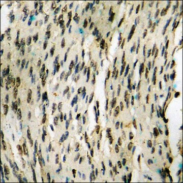 Anti-phospho-NF-kappaB p105/p50 (pSer907) antibody produced in rabbit affinity isolated antibody