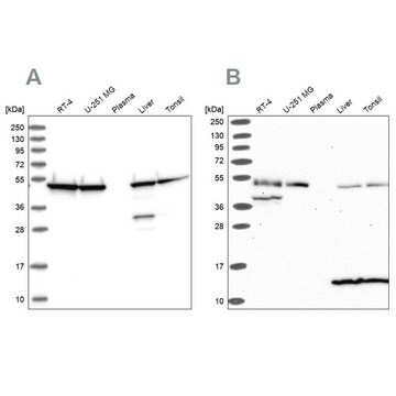 Anti-ST13 antibody produced in rabbit Prestige Antibodies&#174; Powered by Atlas Antibodies, affinity isolated antibody, buffered aqueous glycerol solution