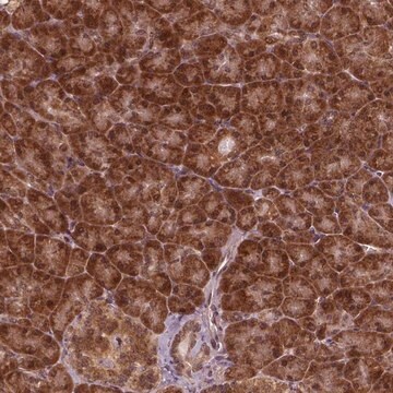 Anti-NUDT9 antibody produced in rabbit Prestige Antibodies&#174; Powered by Atlas Antibodies, affinity isolated antibody, buffered aqueous glycerol solution