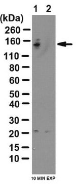 Anti-phospho-TBC1D1 Antibody (Ser237) from rabbit, purified by affinity chromatography