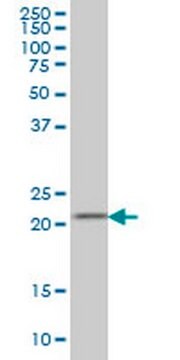 Anti-DFHR Mouse mAb (2B10) liquid, clone 2B10, Calbiochem&#174;