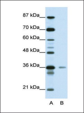 Anti-HMG20A (AB1) antibody produced in rabbit affinity isolated antibody