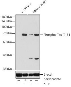 Anti-Phospho-Tau-T181 antibody produced in rabbit