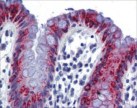 Anti-AGR2 antibody produced in rabbit affinity isolated antibody