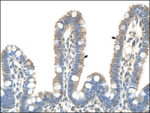 Anti-CLDN18 affinity isolated antibody