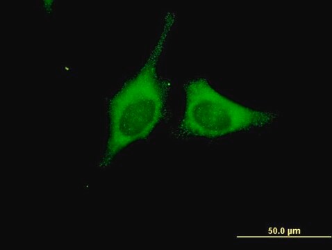 ANTI-BRAF antibody produced in mouse clone 1H7, purified immunoglobulin, buffered aqueous solution