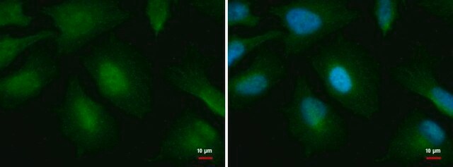 单克隆抗O-GlcNAc转移酶 小鼠抗 clone GT678, affinity isolated antibody