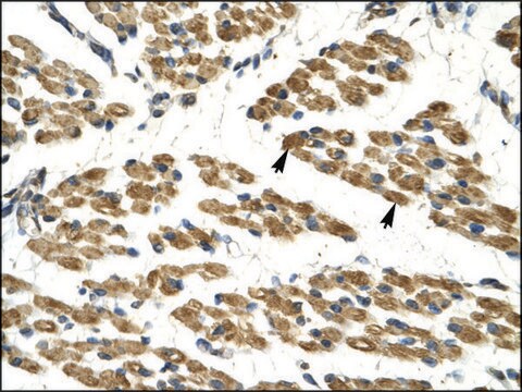 Anti-HHEX antibody produced in rabbit affinity isolated antibody